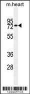 Otopetrin 1 antibody, 56-164, ProSci, Western Blot image 