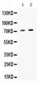 Stress Induced Phosphoprotein 1 antibody, PB9896, Boster Biological Technology, Western Blot image 