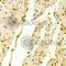 MutS Homolog 2 antibody, A1121, ABclonal Technology, Immunohistochemistry paraffin image 