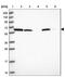 Ankyrin Repeat Domain 34C antibody, NBP2-33442, Novus Biologicals, Western Blot image 