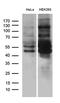 Meis Homeobox 1 antibody, LS-C798715, Lifespan Biosciences, Western Blot image 