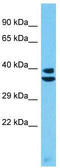 Serine Protease 55 antibody, TA331524, Origene, Western Blot image 
