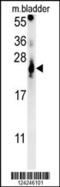 ATP synthase lipid-binding protein, mitochondrial antibody, 62-098, ProSci, Western Blot image 