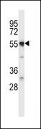 Nramp2 antibody, LS-C161124, Lifespan Biosciences, Western Blot image 
