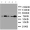 Heat Shock Transcription Factor 1 antibody, orb76120, Biorbyt, Western Blot image 
