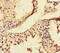 Matrix Metallopeptidase 12 antibody, CSB-PA12379A0Rb, Cusabio, Immunohistochemistry paraffin image 