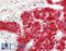 Ras Homolog, MTORC1 Binding antibody, LS-B11962, Lifespan Biosciences, Immunohistochemistry paraffin image 