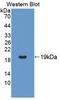 T Cell Lymphoma Invasion And Metastasis 1 antibody, LS-C725970, Lifespan Biosciences, Western Blot image 