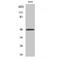 Abhydrolase Domain Containing 2 antibody, LS-C381855, Lifespan Biosciences, Western Blot image 