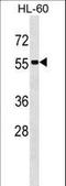 Septin 1 antibody, LS-C168966, Lifespan Biosciences, Western Blot image 