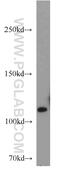 Ubiquitin Specific Peptidase 11 antibody, 10244-1-AP, Proteintech Group, Western Blot image 