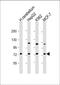 Sphingomyelin Phosphodiesterase 1 antibody, 56-289, ProSci, Western Blot image 