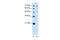 Threonyl-TRNA Synthetase antibody, A03843, Boster Biological Technology, Western Blot image 