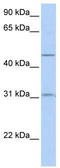 Solute Carrier Family 39 Member 11 antibody, TA333529, Origene, Western Blot image 