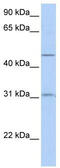 Zinc transporter ZIP11 antibody, TA333529, Origene, Western Blot image 