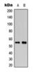RUNX Family Transcription Factor 1 antibody, orb393156, Biorbyt, Western Blot image 