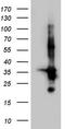 Transforming Acidic Coiled-Coil Containing Protein 2 antibody, CF803726, Origene, Western Blot image 