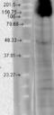 Hyperpolarization Activated Cyclic Nucleotide Gated Potassium Channel 4 antibody, GTX42001, GeneTex, Western Blot image 