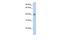 G Protein Subunit Alpha 12 antibody, GTX45376, GeneTex, Western Blot image 