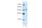 Zinc Finger Protein 296 antibody, 29-141, ProSci, Immunohistochemistry paraffin image 