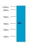 Docking Protein 5 antibody, LS-C317801, Lifespan Biosciences, Western Blot image 