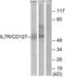 Interleukin 7 Receptor antibody, GTX87162, GeneTex, Western Blot image 