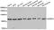 Hydroxysteroid 17-Beta Dehydrogenase 10 antibody, A03844, Boster Biological Technology, Western Blot image 