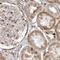 Nucleoporin 43 antibody, NBP1-88792, Novus Biologicals, Immunohistochemistry paraffin image 