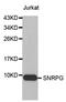 Small nuclear ribonucleoprotein G antibody, MBS128630, MyBioSource, Western Blot image 