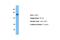 SP140 Nuclear Body Protein antibody, NBP1-80009, Novus Biologicals, Western Blot image 