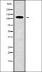 Cleavage And Polyadenylation Specific Factor 6 antibody, orb338193, Biorbyt, Western Blot image 