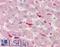 Branched Chain Amino Acid Transaminase 1 antibody, LS-B15397, Lifespan Biosciences, Immunohistochemistry paraffin image 