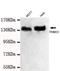Tripartite Motif Containing 33 antibody, M03133, Boster Biological Technology, Western Blot image 