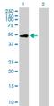 Colony Stimulating Factor 2 Receptor Alpha Subunit antibody, H00001438-B01P, Novus Biologicals, Western Blot image 