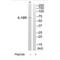 Interleukin 18 Receptor 1 antibody, A04252, Boster Biological Technology, Western Blot image 