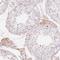 Complement Factor H Related 2 antibody, NBP2-48947, Novus Biologicals, Immunohistochemistry frozen image 