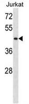 Serine/Threonine Kinase 33 antibody, AP54076PU-N, Origene, Western Blot image 