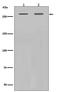 Filamin A antibody, M00502, Boster Biological Technology, Western Blot image 