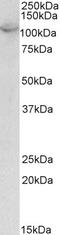 Chloride Intracellular Channel 1 antibody, 43-506, ProSci, Enzyme Linked Immunosorbent Assay image 