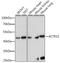 Actin Related Protein 10 antibody, 16-287, ProSci, Western Blot image 