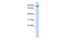 ATM Interactor antibody, GTX44610, GeneTex, Western Blot image 