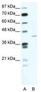 Zinc Finger Protein 568 antibody, TA337713, Origene, Western Blot image 