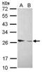 CRDGF antibody, PA5-27298, Invitrogen Antibodies, Western Blot image 