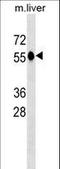 Catalase antibody, LS-C159271, Lifespan Biosciences, Western Blot image 