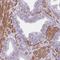 Tubulointerstitial Nephritis Antigen Like 1 antibody, NBP2-13434, Novus Biologicals, Immunohistochemistry paraffin image 