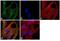 Nuclear Receptor Subfamily 1 Group H Member 2 antibody, GTX82863, GeneTex, Immunocytochemistry image 