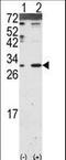 Dickkopf WNT Signaling Pathway Inhibitor 2 antibody, LS-B11830, Lifespan Biosciences, Western Blot image 