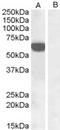 Interferon Regulatory Factor 5 antibody, orb18401, Biorbyt, Western Blot image 
