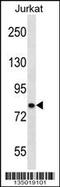 Calcium Voltage-Gated Channel Auxiliary Subunit Beta 2 antibody, 58-054, ProSci, Western Blot image 