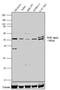 Nuclear receptor ROR-alpha antibody, GTX79267, GeneTex, Western Blot image 